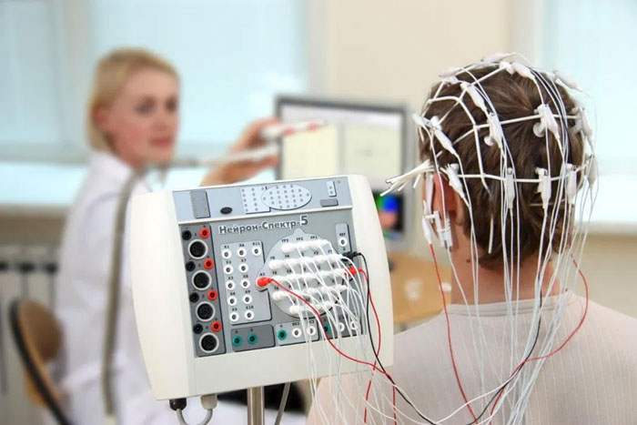 دستگاه الکتروآنسفالوگرام یا EEG